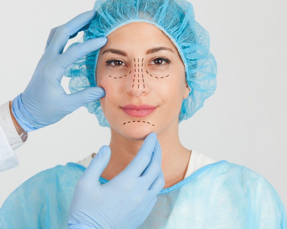 Nose job- Rhinoplasty